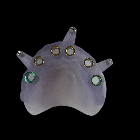 Surgical Guides Successful Procedures Our Products Apex Dental