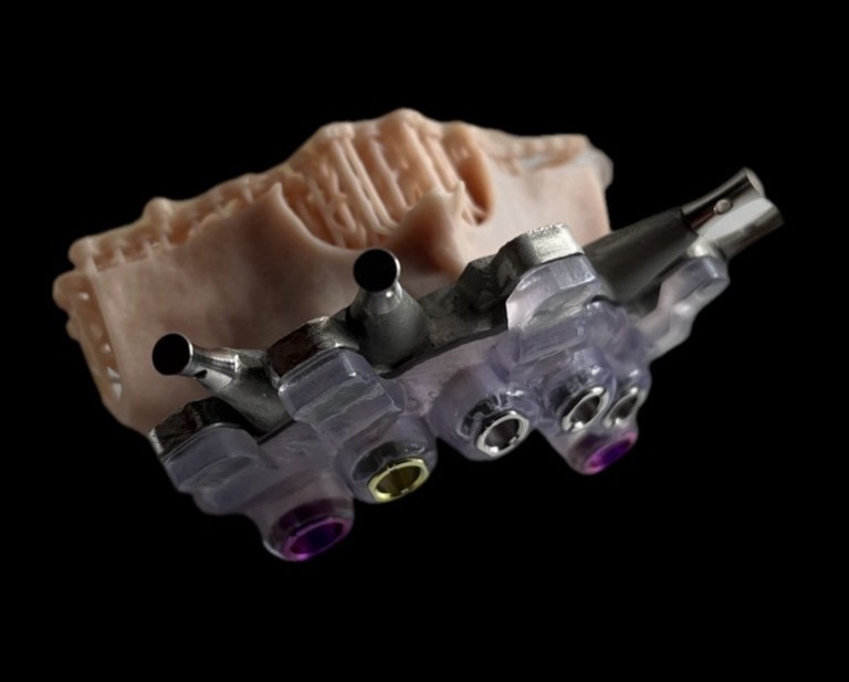 Complete Prosthetic Deliver Guide